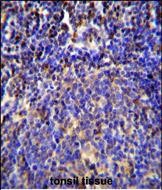 IHC-P - S100A4 Antibody (N-term) AP11782a